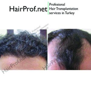 hairprof.net result 17